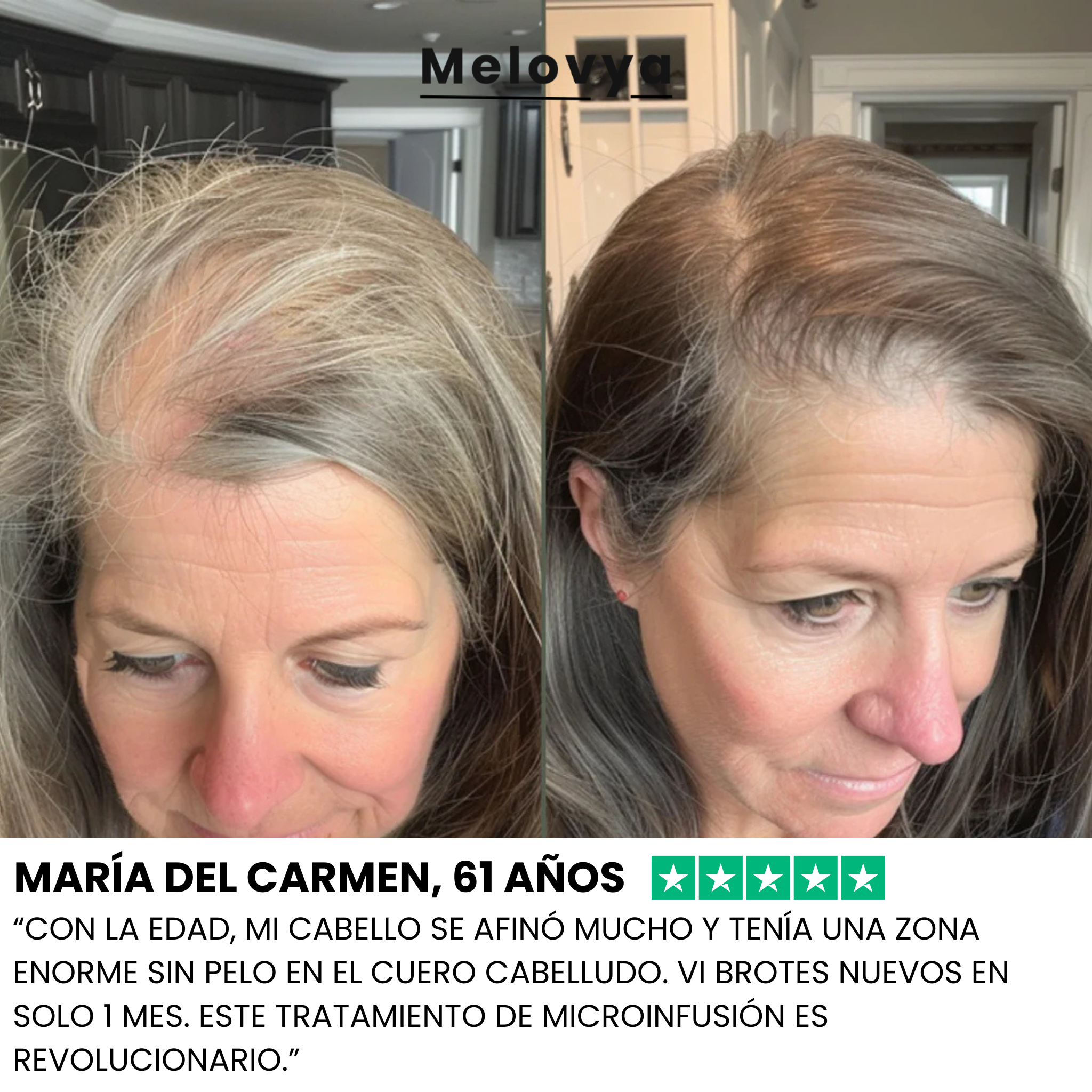 Melovya sistema de repulsión y anticaída